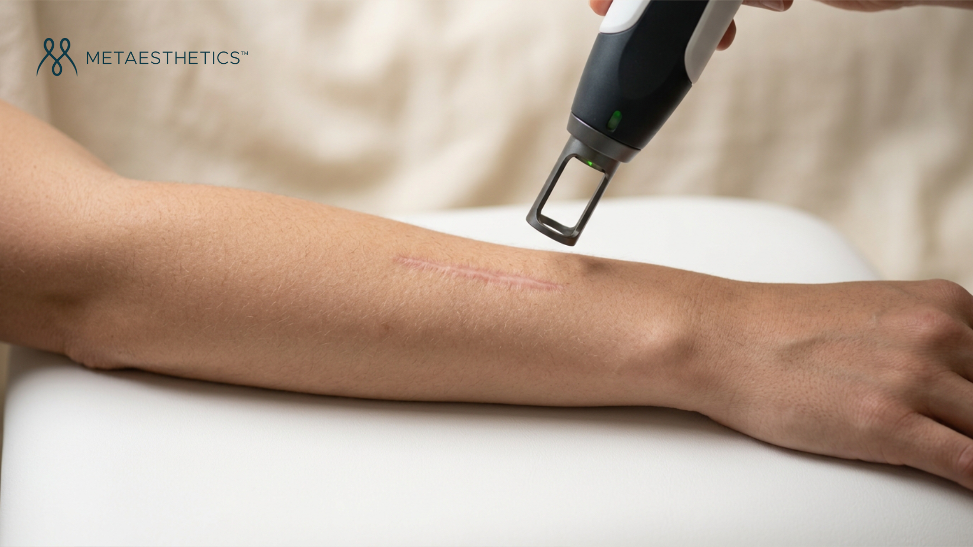 Scar treatment: a complete guide to understanding and taking action