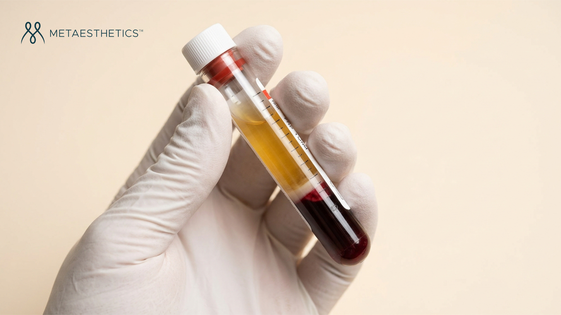 PRP: a complete guide to platelet-rich plasma